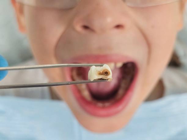 Best Teeth Whitening  in Elm City, NC